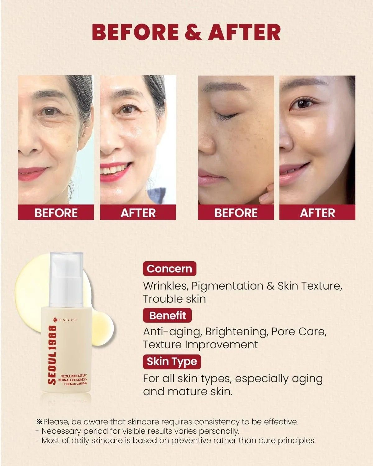 K-SECRET - SEOUL 1988 Cream: Retinal Liposome 1% + Fermented Rice