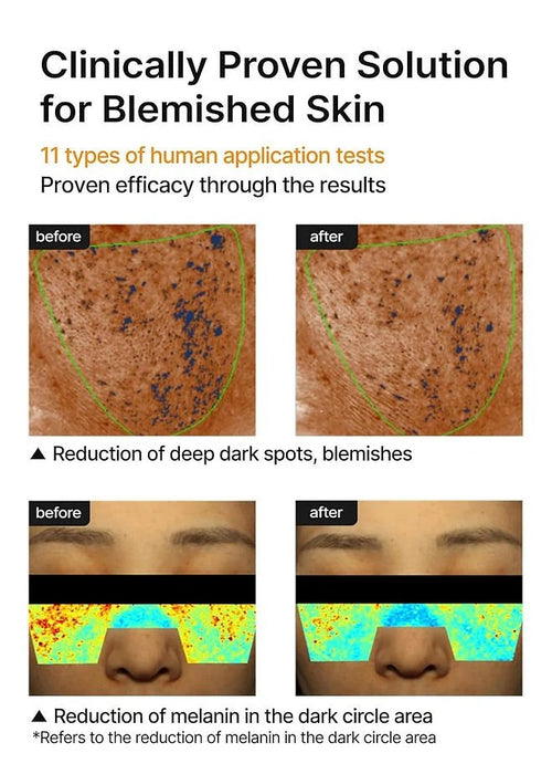 CELIMAX - Pore + Dark Spot Brightening Cream